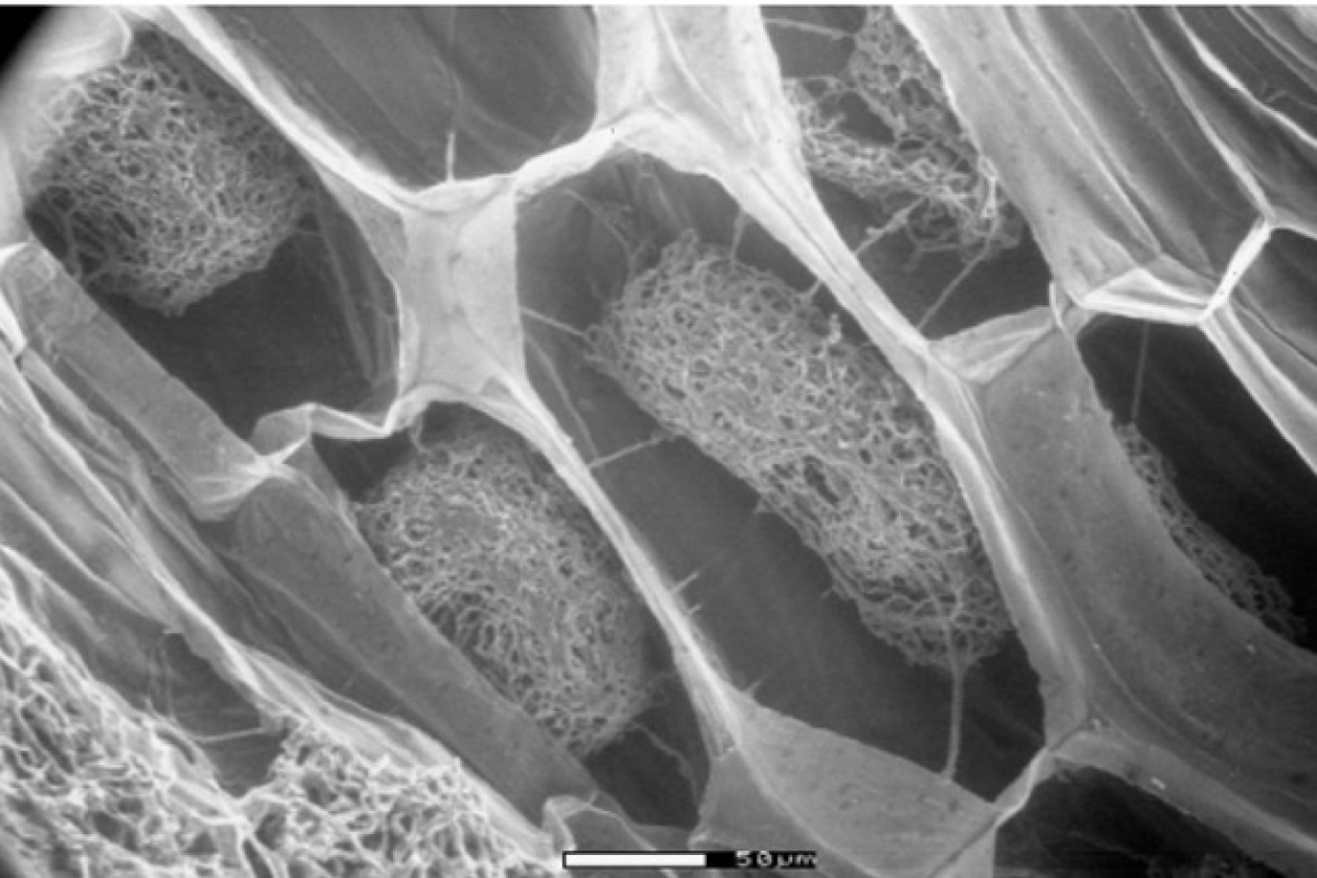 An electron microscope image zoomed in of bundles of fungi